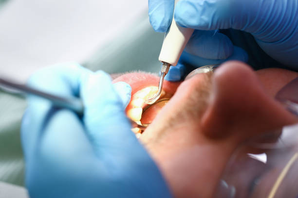 Best Emergency Dental Surgery in Fullerton, PA