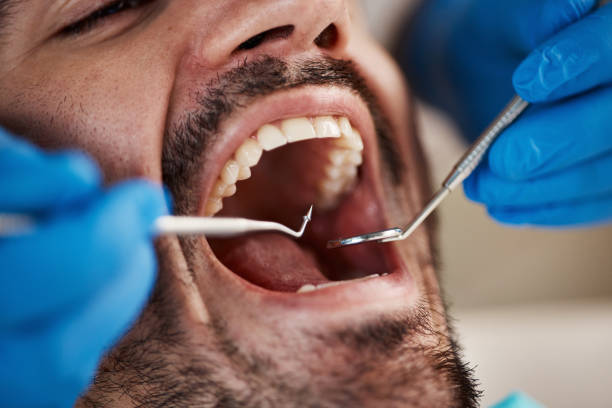 Best Emergency Dental Care for Trauma or Injury in Fullerton, PA