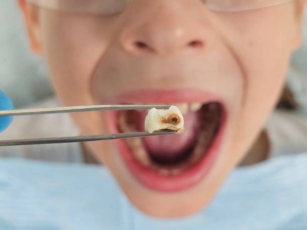 Best Emergency Treatment for Toothache in Fullerton, PA